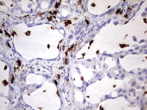 Monoclonal Mouse anti-Human S100A9 / MRP14 Antibody (clone OTI10D5, IHC, WB)