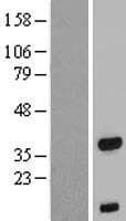 FOXB1 Protein (Over-Expression Lysate Myc-DDK (Flag))