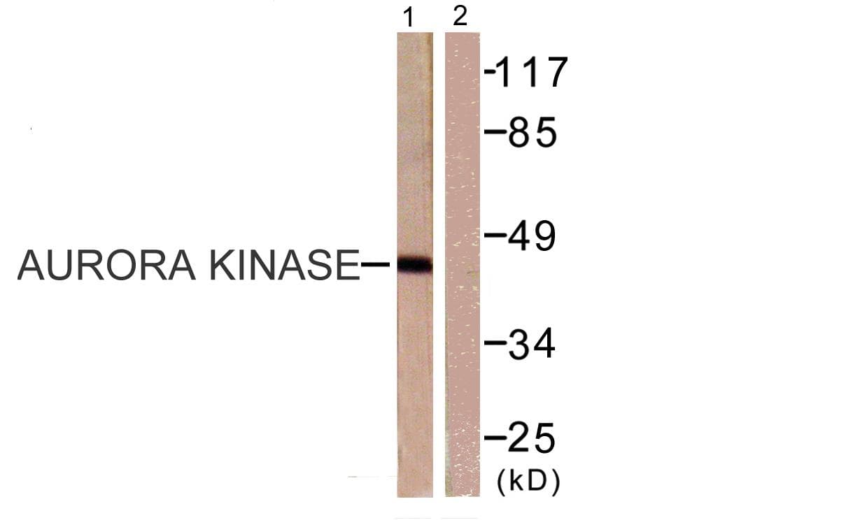 AURKA / Aurora-A Antibody (p288)