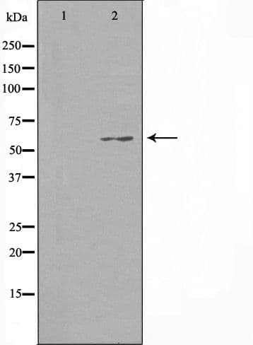 CCDC102B Antibody