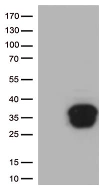 BCL2 / Bcl-2 Antibody (clone UMAB225)