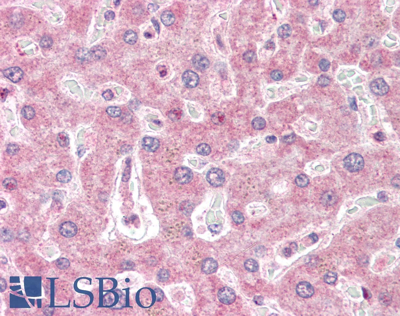 IHC-plus™ IRAK2 / IRAK-2 Antibody