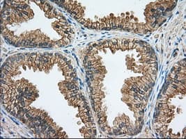 RAB17 Antibody (clone OTI5E2)