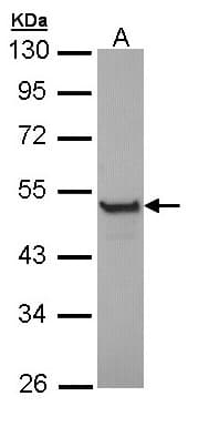 Polyclonal Rabbit anti-Human KRT13 / CK13 / Cytokeratin 13 Antibody (aa198-438, IHC, WB)