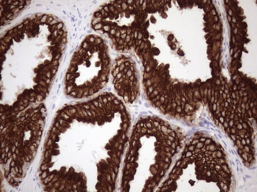 KRT18 / CK18 / Cytokeratin 18 Antibody (aa69-372, clone OTI3D1)