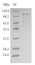 Human IL1R1 Protein (Recombinant 10His-SUMO, N-terminus + Myc, C-terminus)