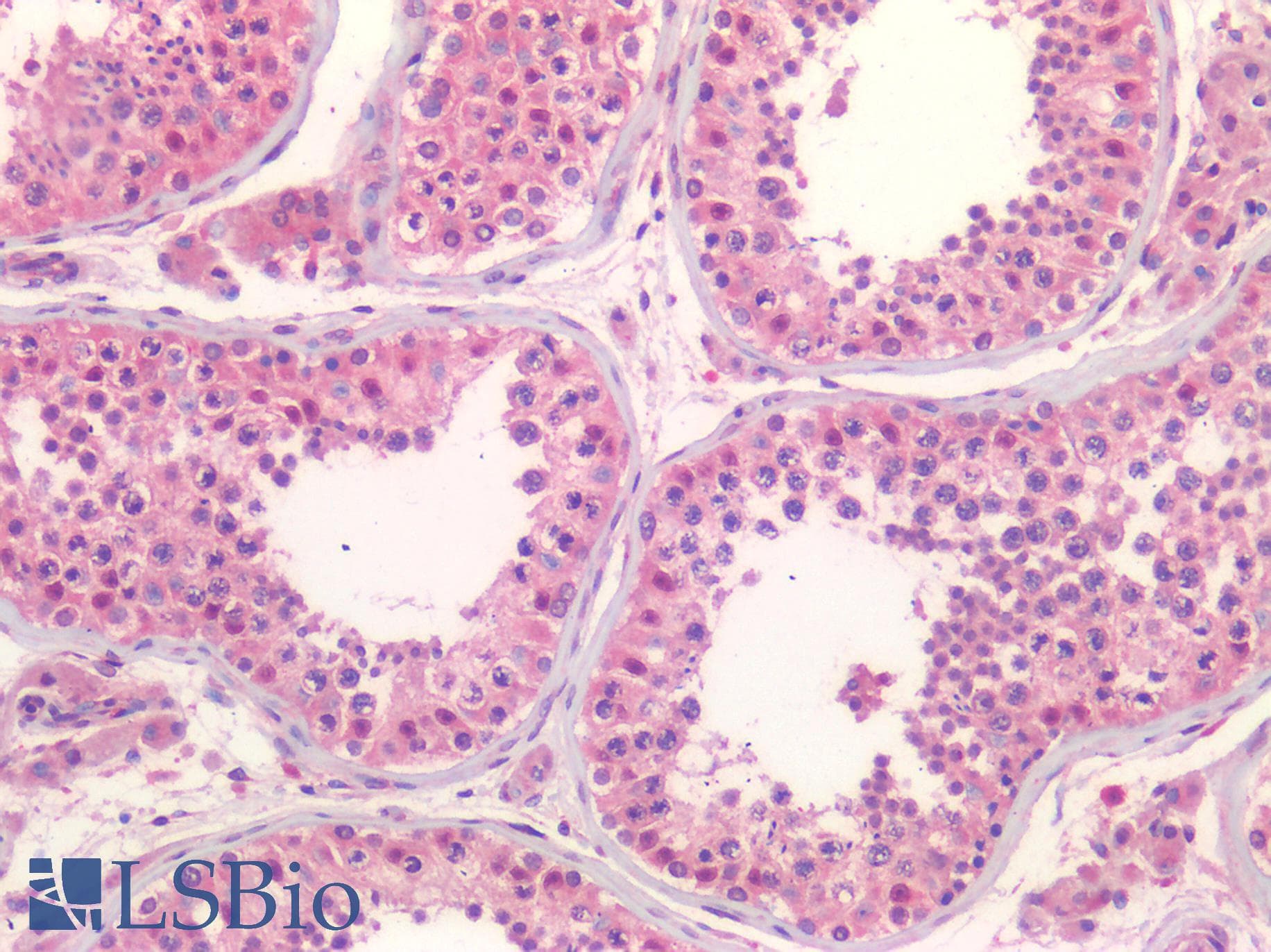 IHC-plus™ P2RX3 / P2X3 Antibody