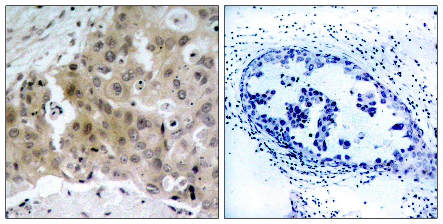 KDR / VEGFR2 / FLK1 Antibody (phospho-Tyr1175)