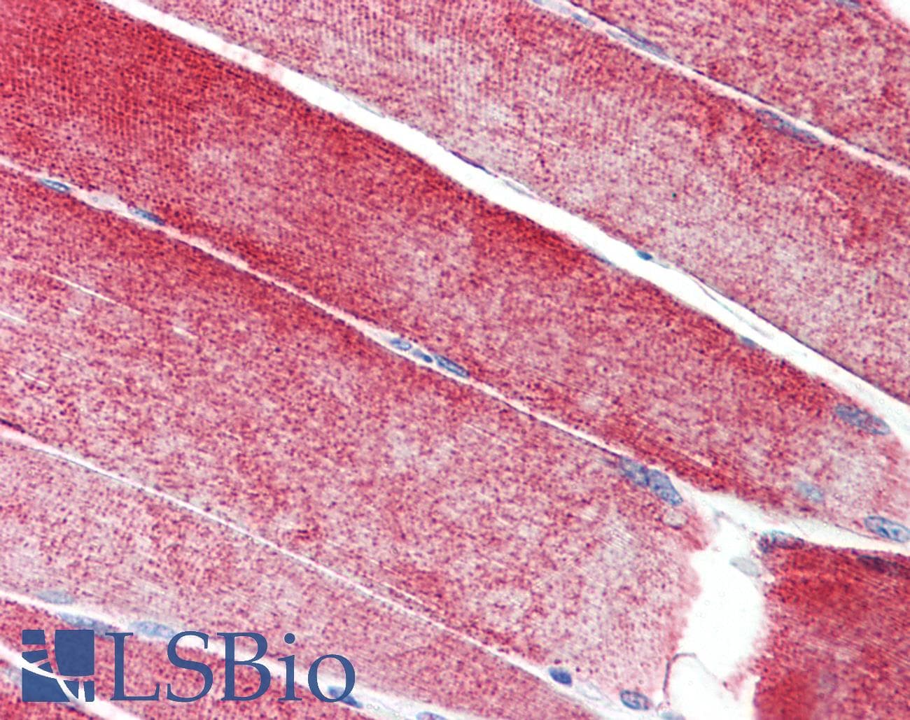 IHC-plus™ MAP3K10 / MLK2 Antibody (aa110-138)