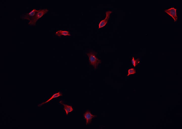 Polyclonal Rabbit anti-Human PDGFRA / PDGFR Alpha Antibody (IHC, IF, WB)