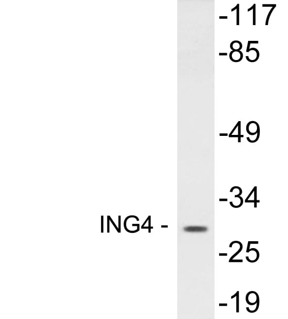 ING4 Antibody (aa107-156)