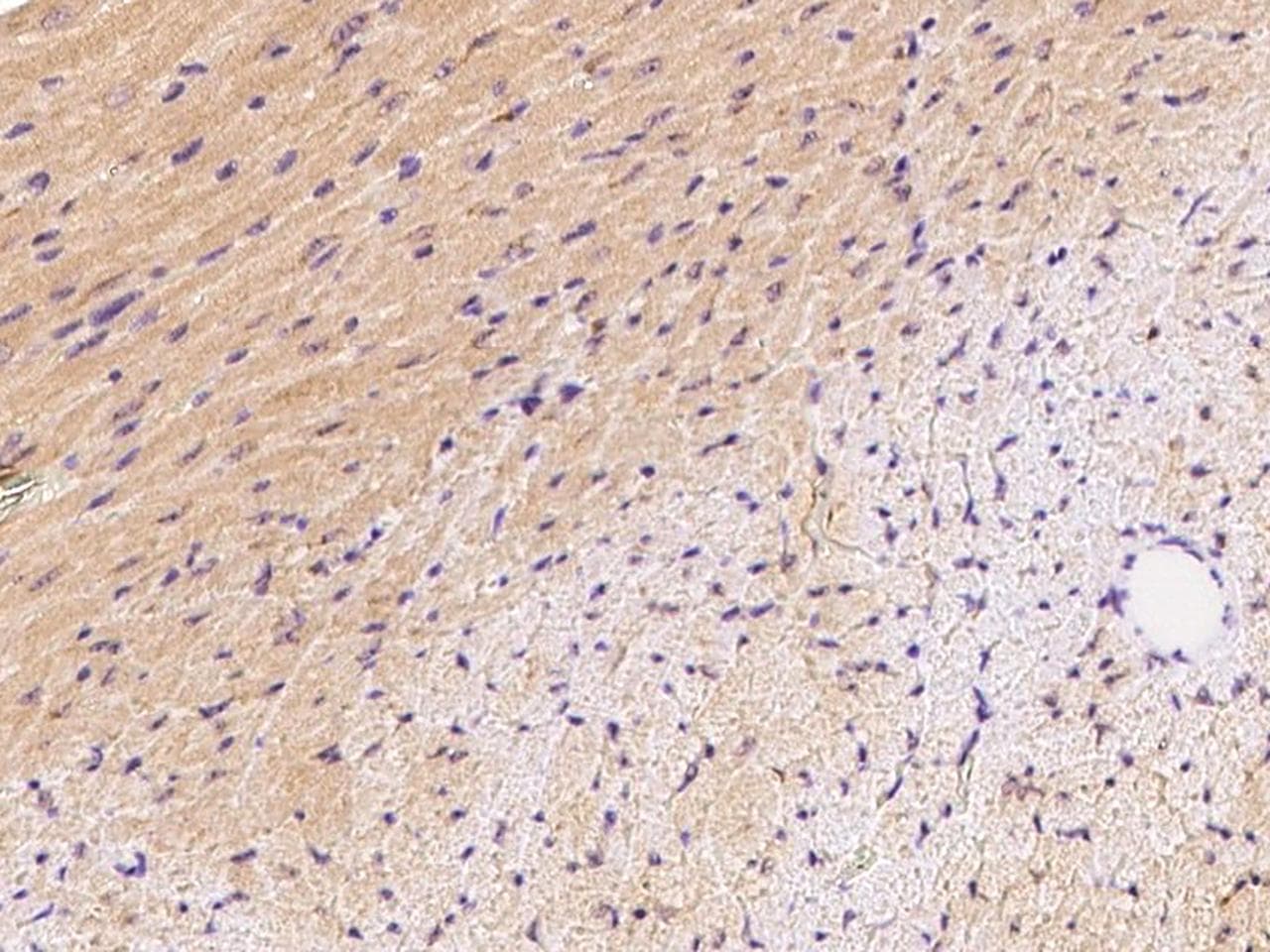 Polyclonal Rabbit anti-Mouse FNDC5 / Irisin Antibody (Preservative Free, IHC)