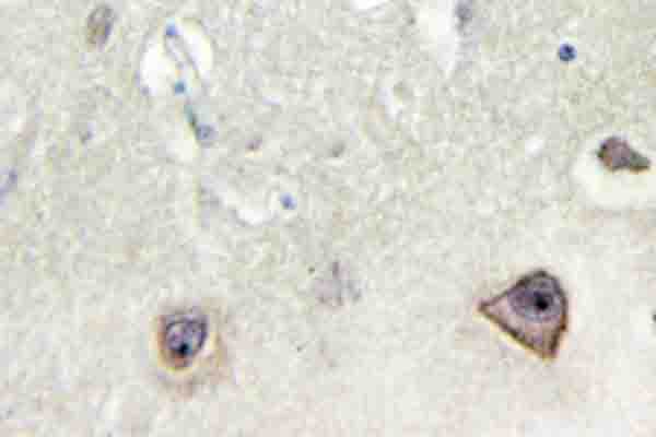 GRIN1 / NMDAR1 Antibody (Phe891)