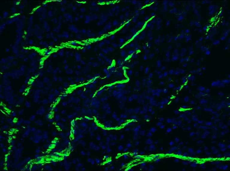 PathPlus™ DES / Desmin Antibody (clone D9)