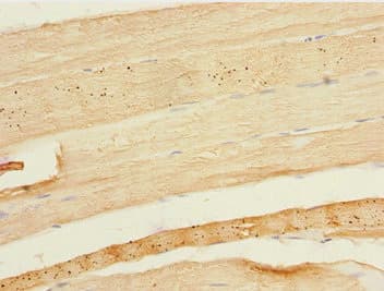 Polyclonal Rabbit anti-Human ESE3 / EHF Antibody (IHC, WB)