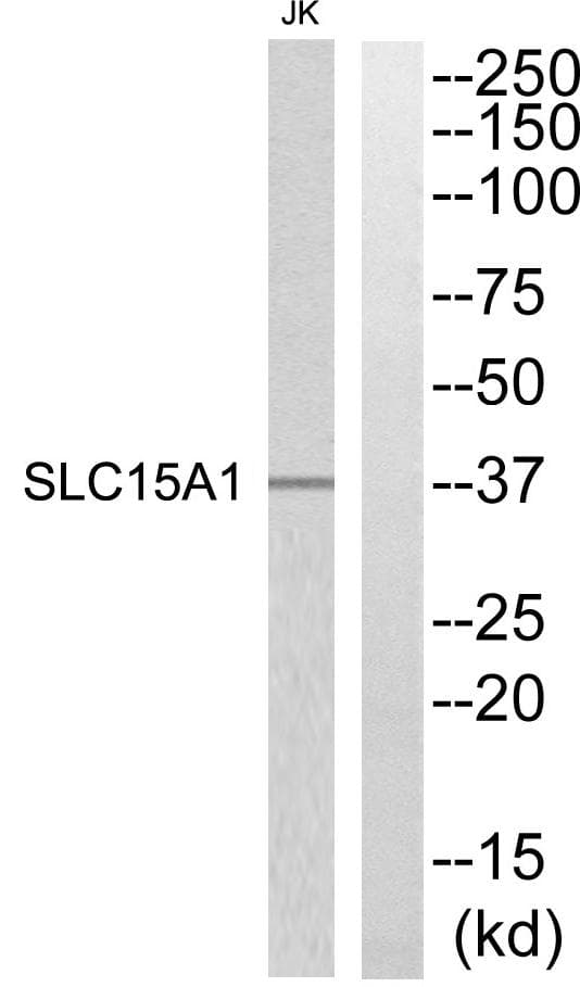 Polyclonal Rabbit anti-Human SLC15A1 / PEPT1 Antibody (WB)