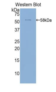 ALCAM / CD166 Antibody (aa28-527)