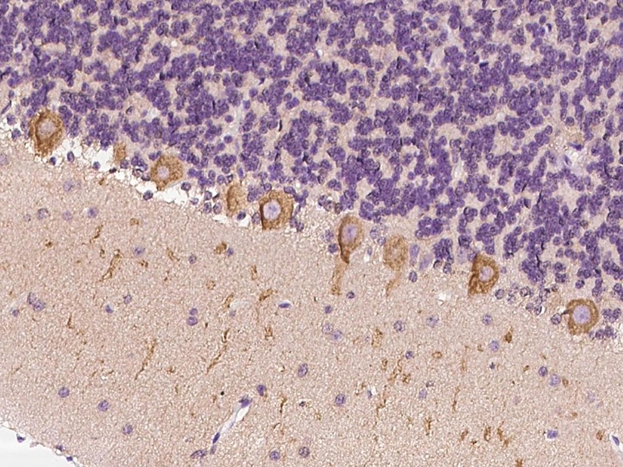 ICMT / PPMT Antibody