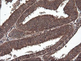 CTAG1B / NY-ESO-1 Antibody (clone OTI5B2)
