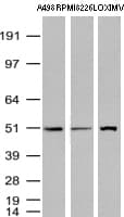 Monoclonal Mouse anti-Human TP / Thymidine Phosphorylase Antibody (clone UMAB90, aa311-482, IHC, WB)
