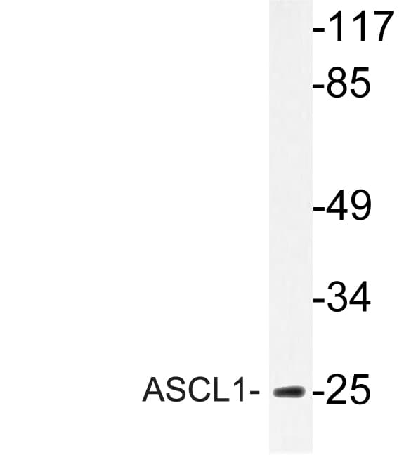 ASCL1 / MASH1 Antibody (aa109-158)