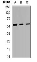 PROC / Protein C Antibody (Internal)