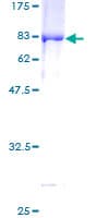Human PPARG / PPAR Gamma Protein (Recombinant GST)