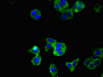 TNFSF11 / RANKL / TRANCE Antibody