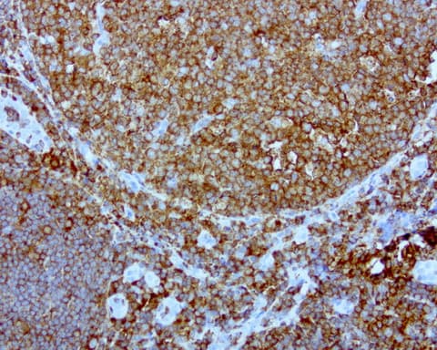 DOCK2 Antibody (aa1544-1830, clone UMAB142)
