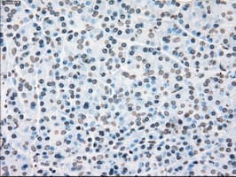 PLK1 / PLK-1 Antibody (clone OTI1D4)