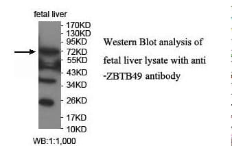 Polyclonal Rabbit anti-Human ZNF509 / ZBTB49 Antibody (aa441-637, IHC, WB)