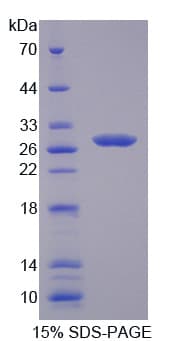 Human LAMB4 / Laminin Beta 4 Protein (Recombinant His-T7)