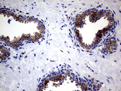 CLTA / LCA Antibody (clone OTI2F7)
