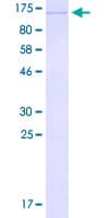 Human ALDH18A1 Protein (Recombinant GST)