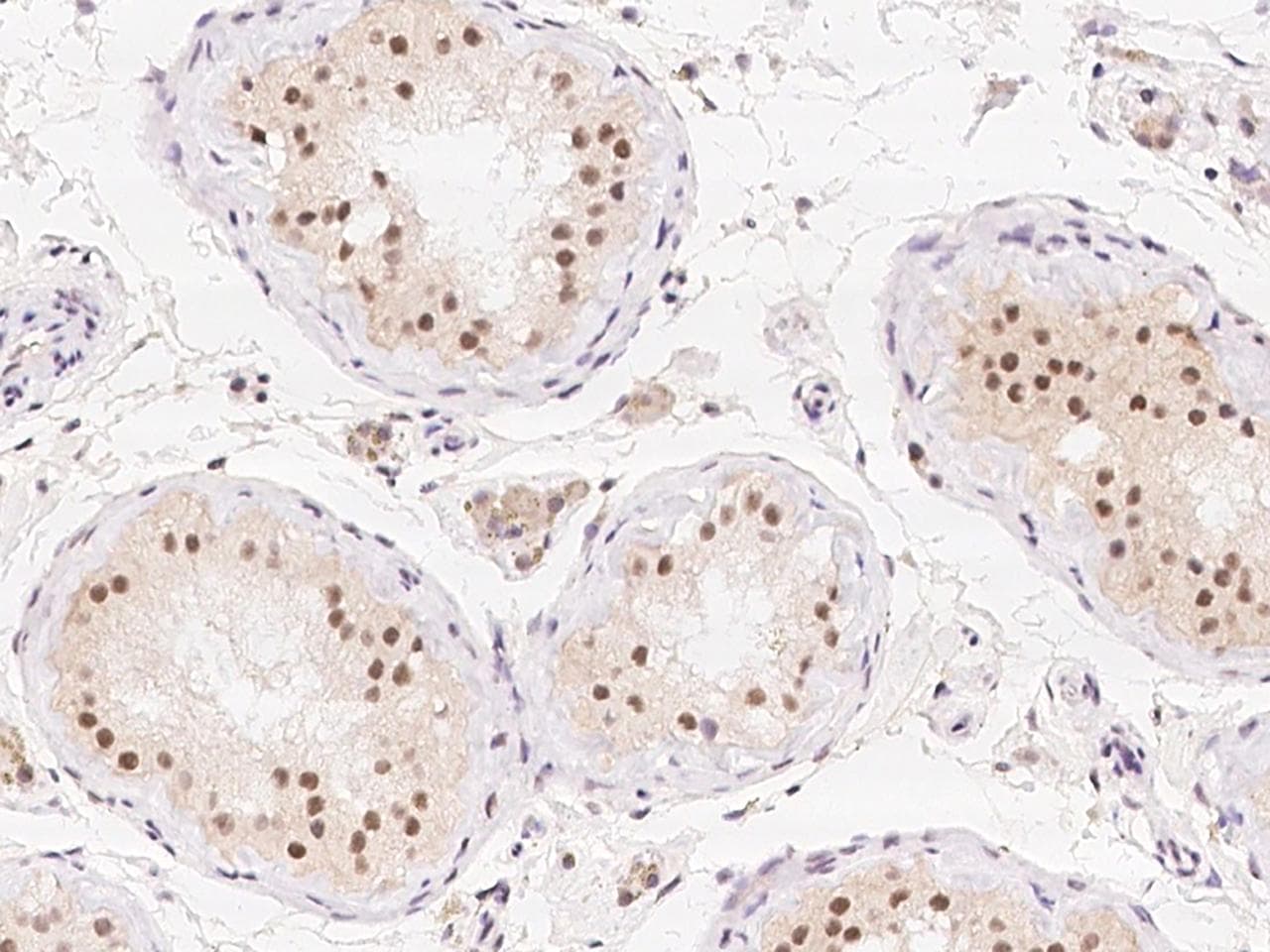 CCDC178 / C18orf34 Antibody