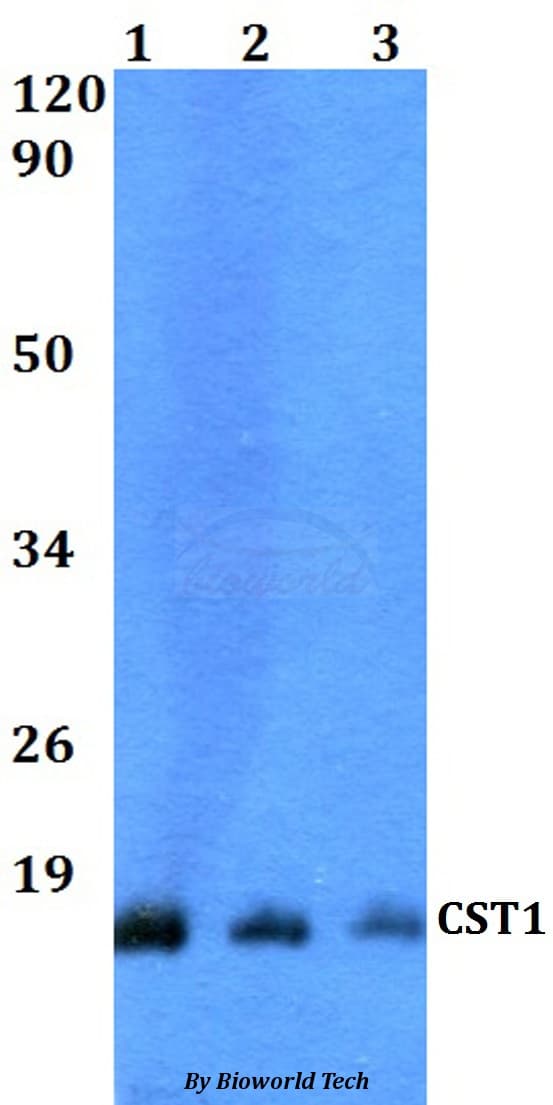 Polyclonal Rabbit anti-Human CST1 / Cystatin SN Antibody (WB)