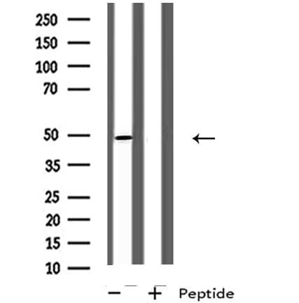 GPR142 Antibody