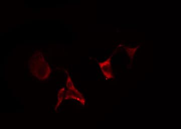 Polyclonal Rabbit anti-Human CYP2E1 Antibody (IHC, IF, WB)