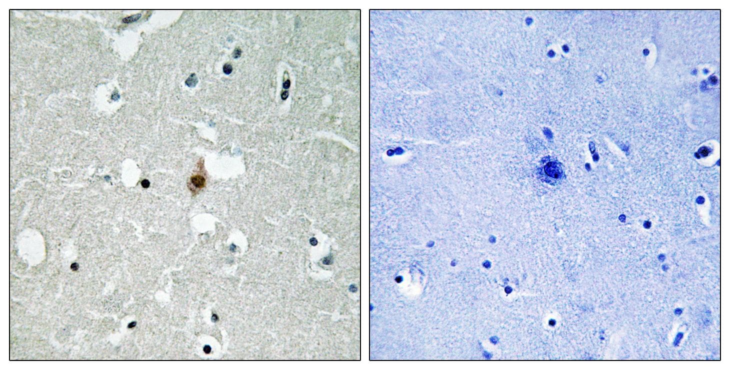 TCF3 / E2A Antibody (Ab-355)