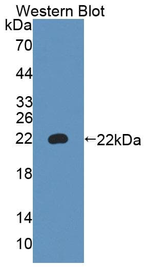 A4GALT Antibody (aa94-270, PE)