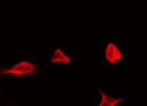 Polyclonal Rabbit anti-Human MLANA / Melan-A Antibody (IHC, IF, WB)