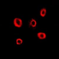 IHC-plus™ RRM2 Antibody