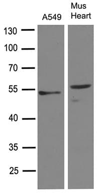 TGFB2 / TGF Beta2 Antibody