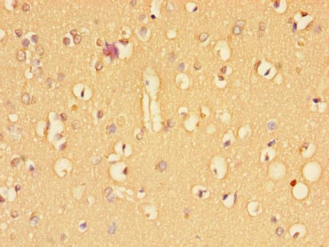 TGFBR2 Antibody