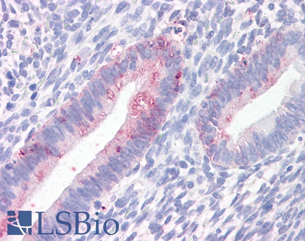 IHC-plus™ Prominin 2 / PROM2 Antibody (N-Terminus)