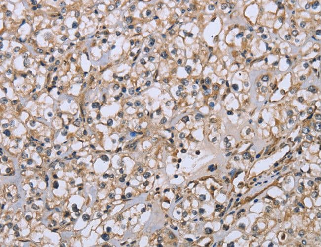 DTNB / Dystrobrevin Beta Antibody