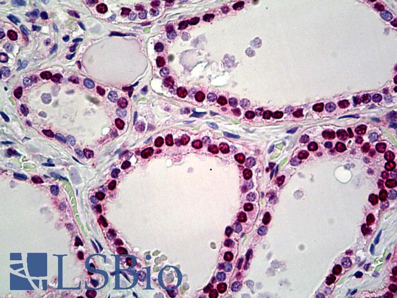 IHC-plus™ HMGN2 Antibody (aa1-50)