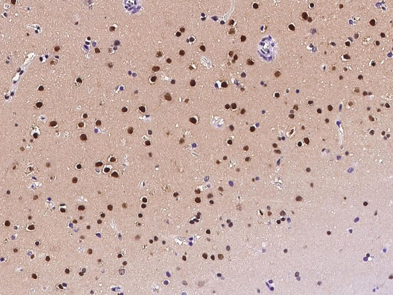 ZDHHC12 Antibody