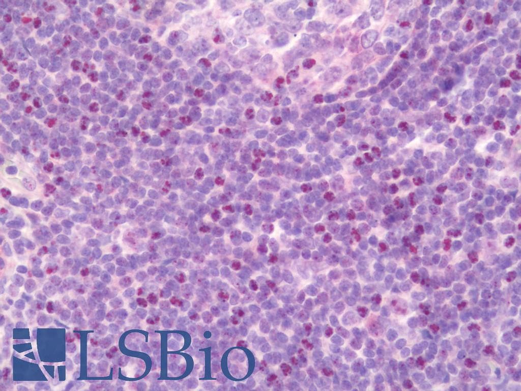 IHC-plus™ CNOT4 / CLONE243 Antibody (aa61-110)
