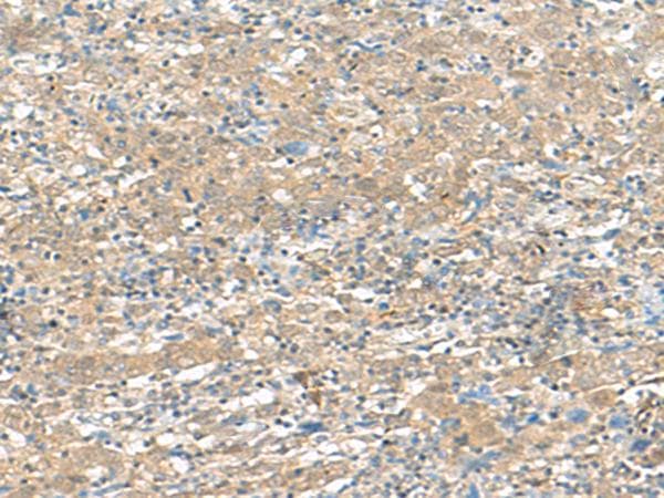 HMBOX1 Antibody